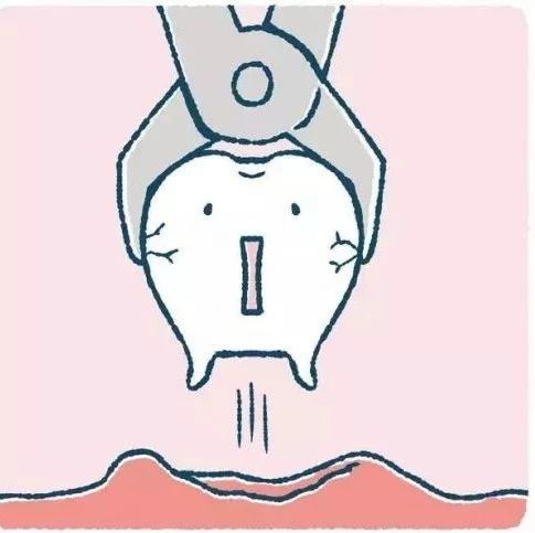 智齿可以拔掉吗